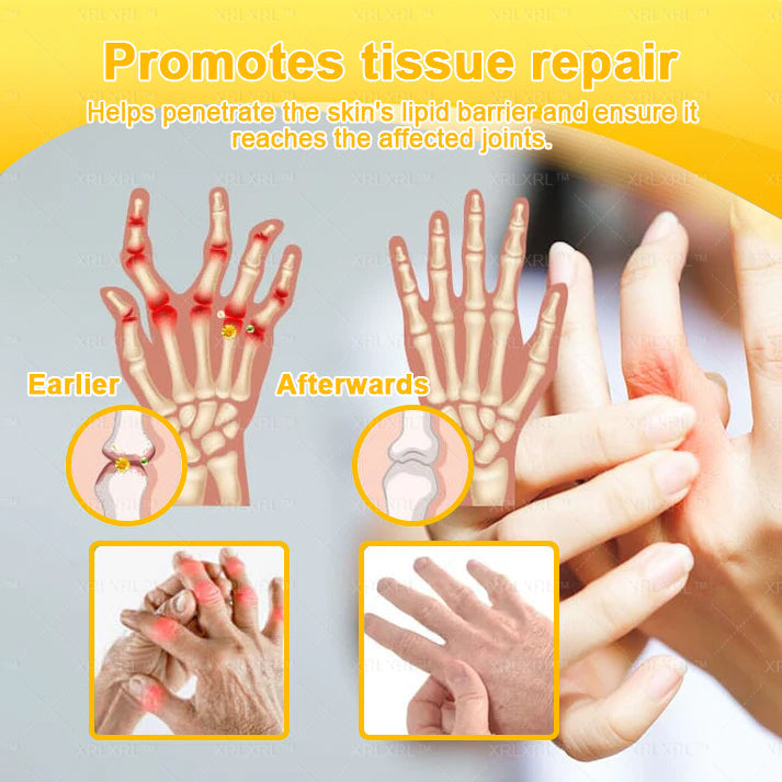 XRLXRL® Bee Venom Pain-Relief Bone Healing Cream 🌟(Specially for older adults)