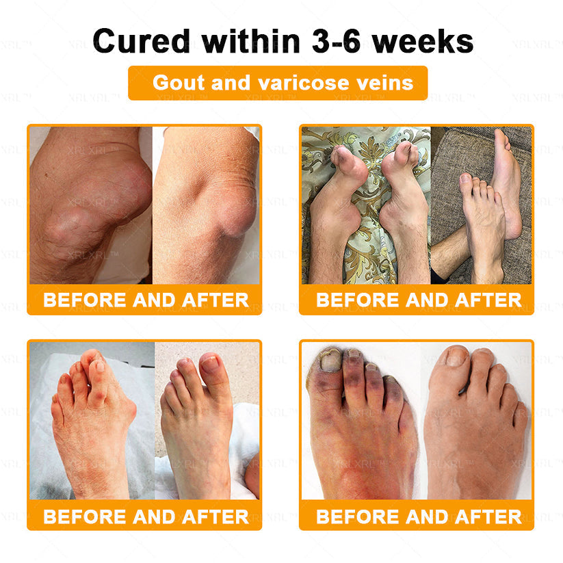 XRLXRL® Bee Venom Pain-Relief Bone Healing Cream 🌟(Specially for older adults)