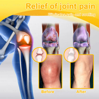 XRLXRL® Bee Venom Pain-Relief Bone Healing Cream 🌟(Specially for older adults)